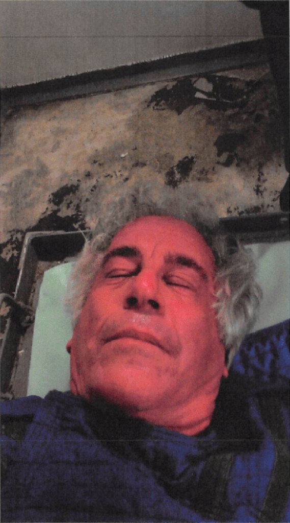 Epstein autopsy photo — graphic
